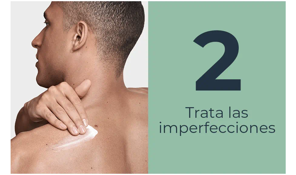 Trata las imperfecciones