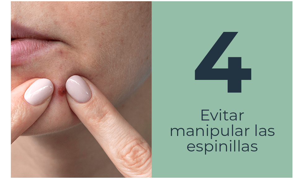 Evitar manipular las espinillas