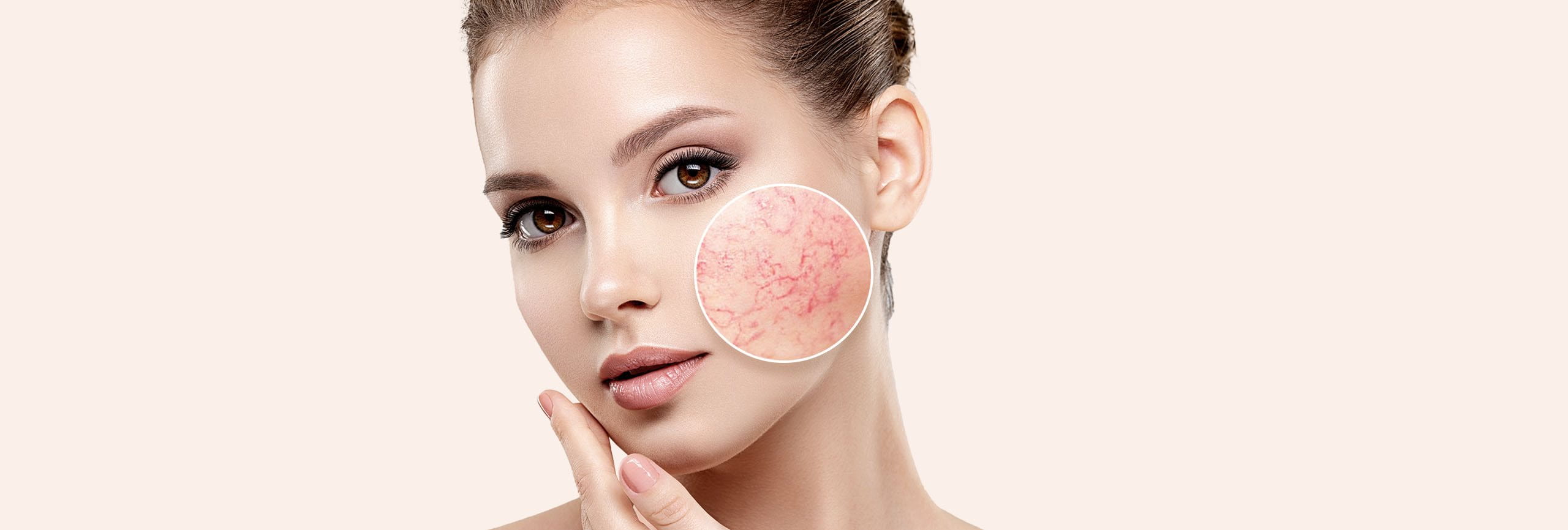 Chica con la piel del rostro sensible