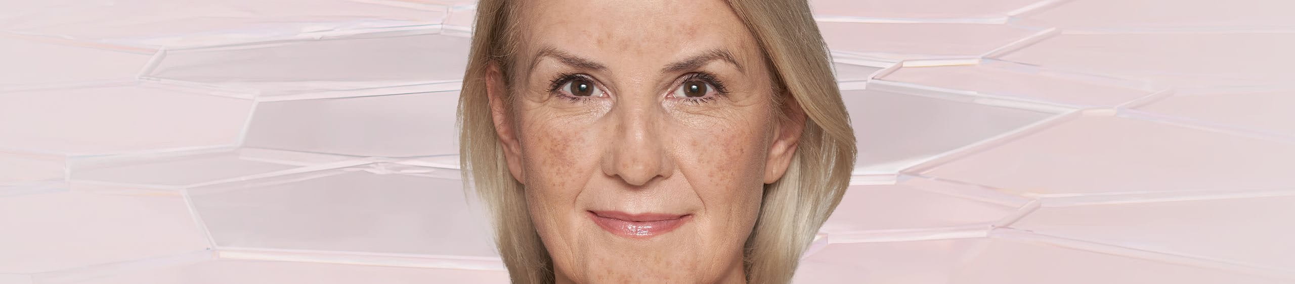 Manchas en la piel causadas por la edad