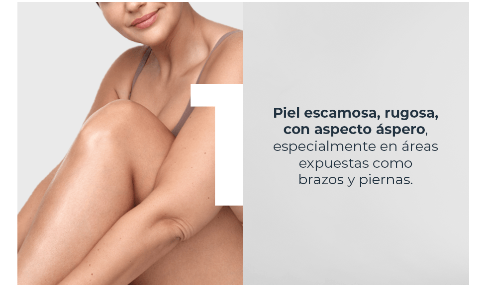 Piel escamosa, rugosa, con aspecto áspero