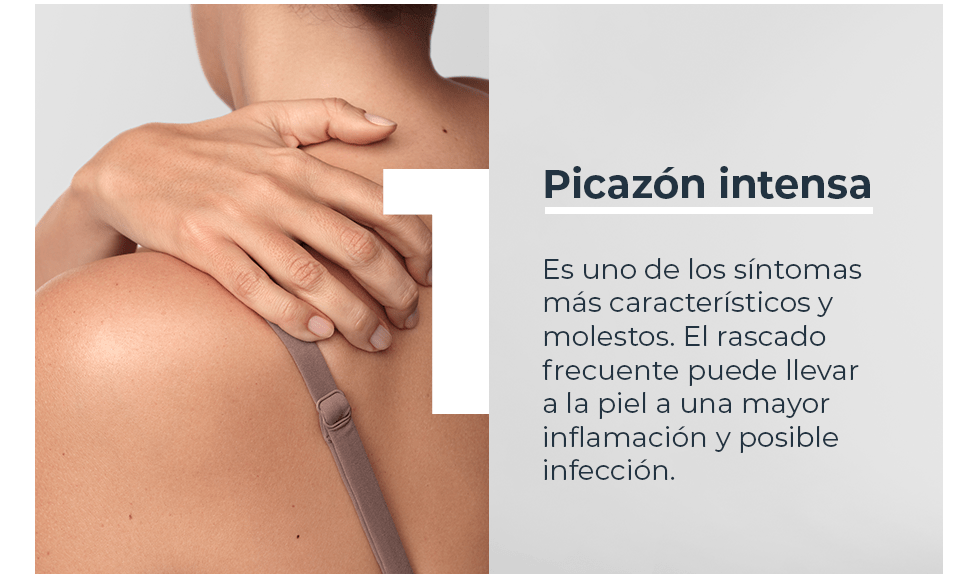 Picazón intensa