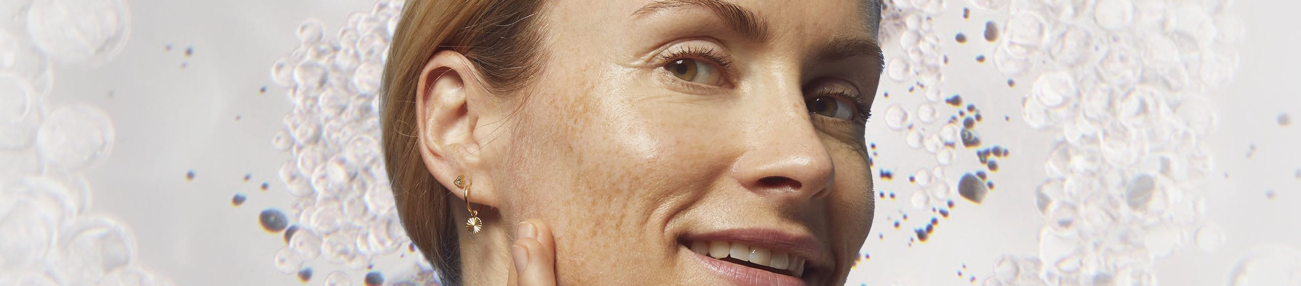 Prevenir la hiperpigmentación facial