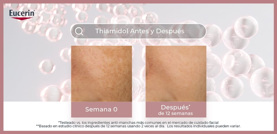 Beneficios del Thiamidol