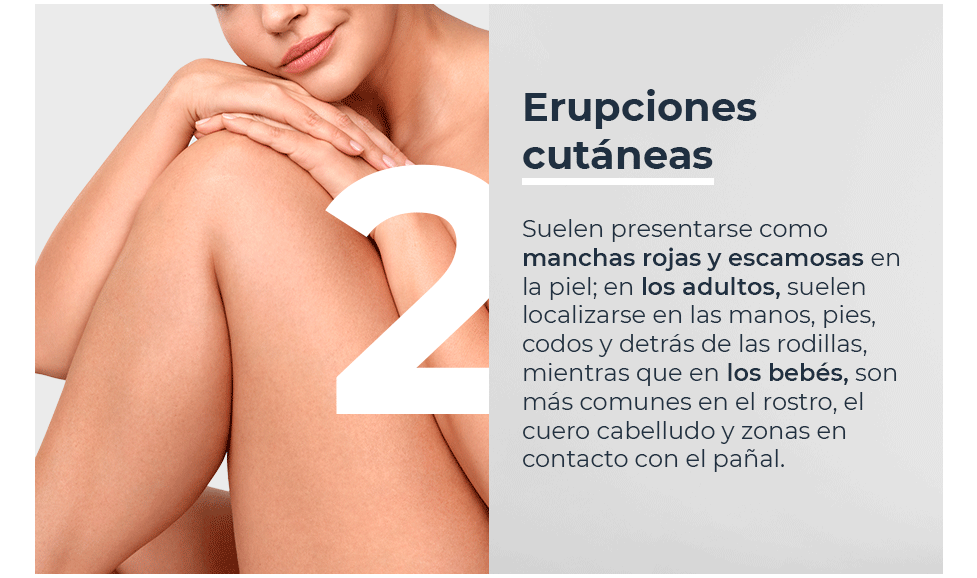 Erupciones cutáneas