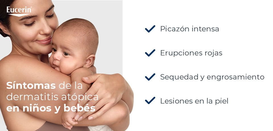 Síntomas de la dermatitis atópica en niños y bebés