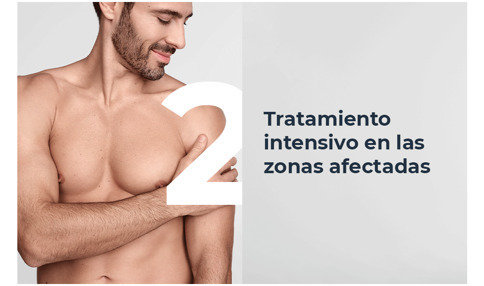 Tratamiento intensivo en las zonas afectadas