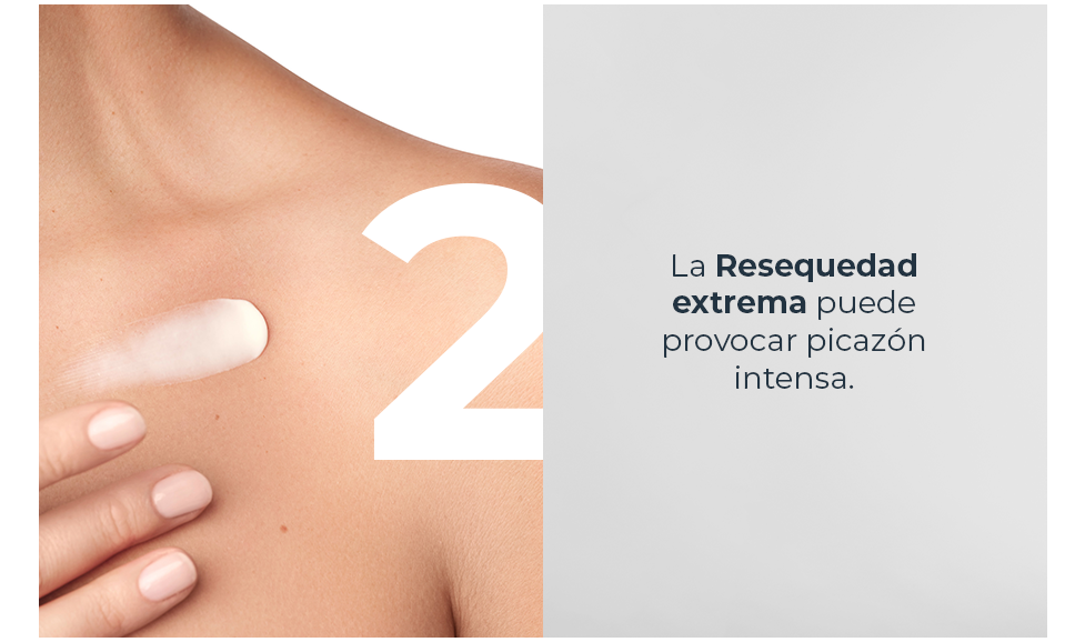 La resequedad extrema puede provocar picazón