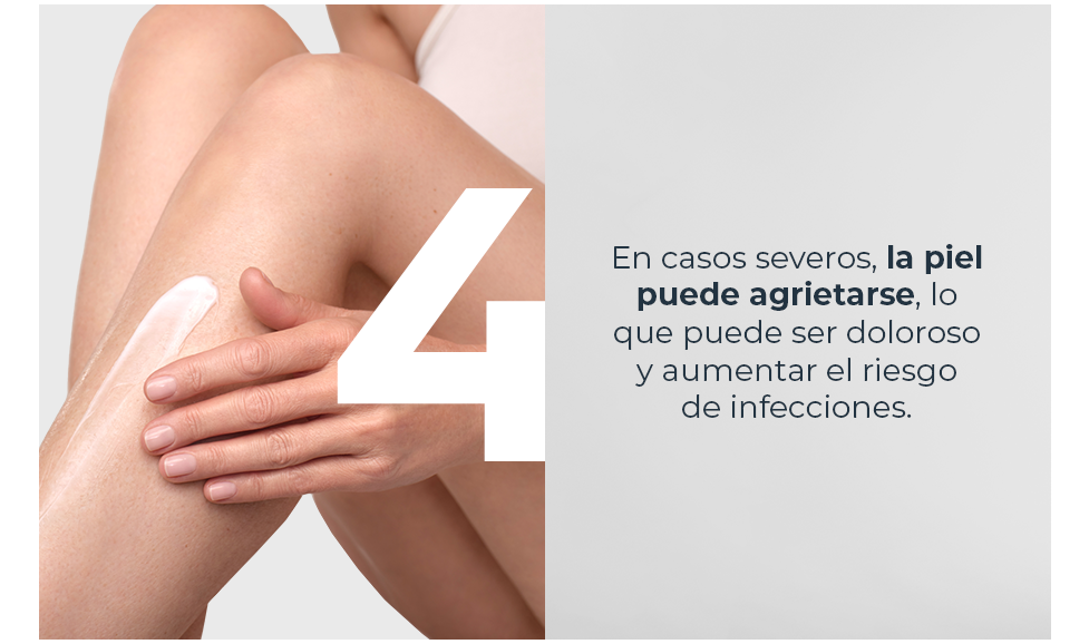 La piel puede agrietarse