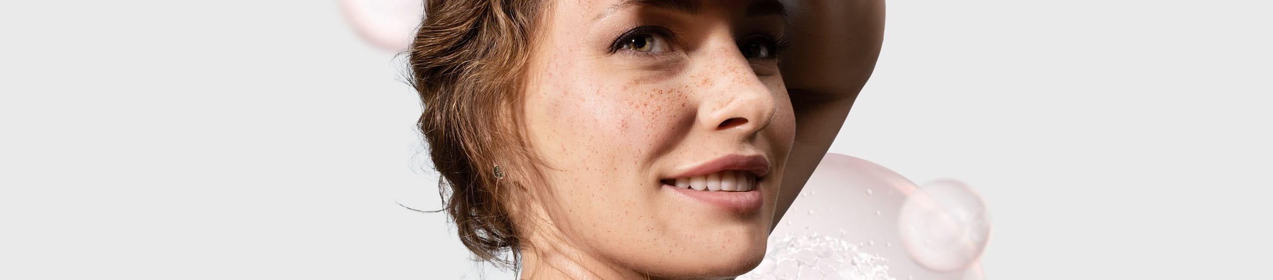 Manchas en la piel causadas por el sol