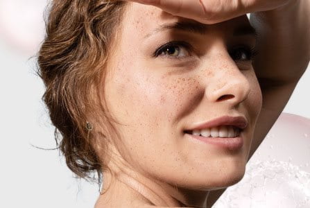 Manchas en la piel causadas por el sol