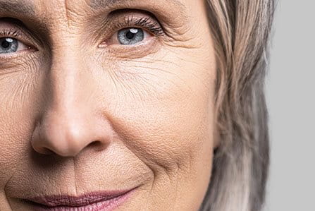 Mujer con arrugas en el rostro