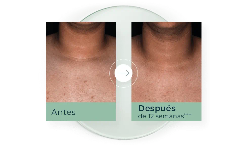Antes y después 2