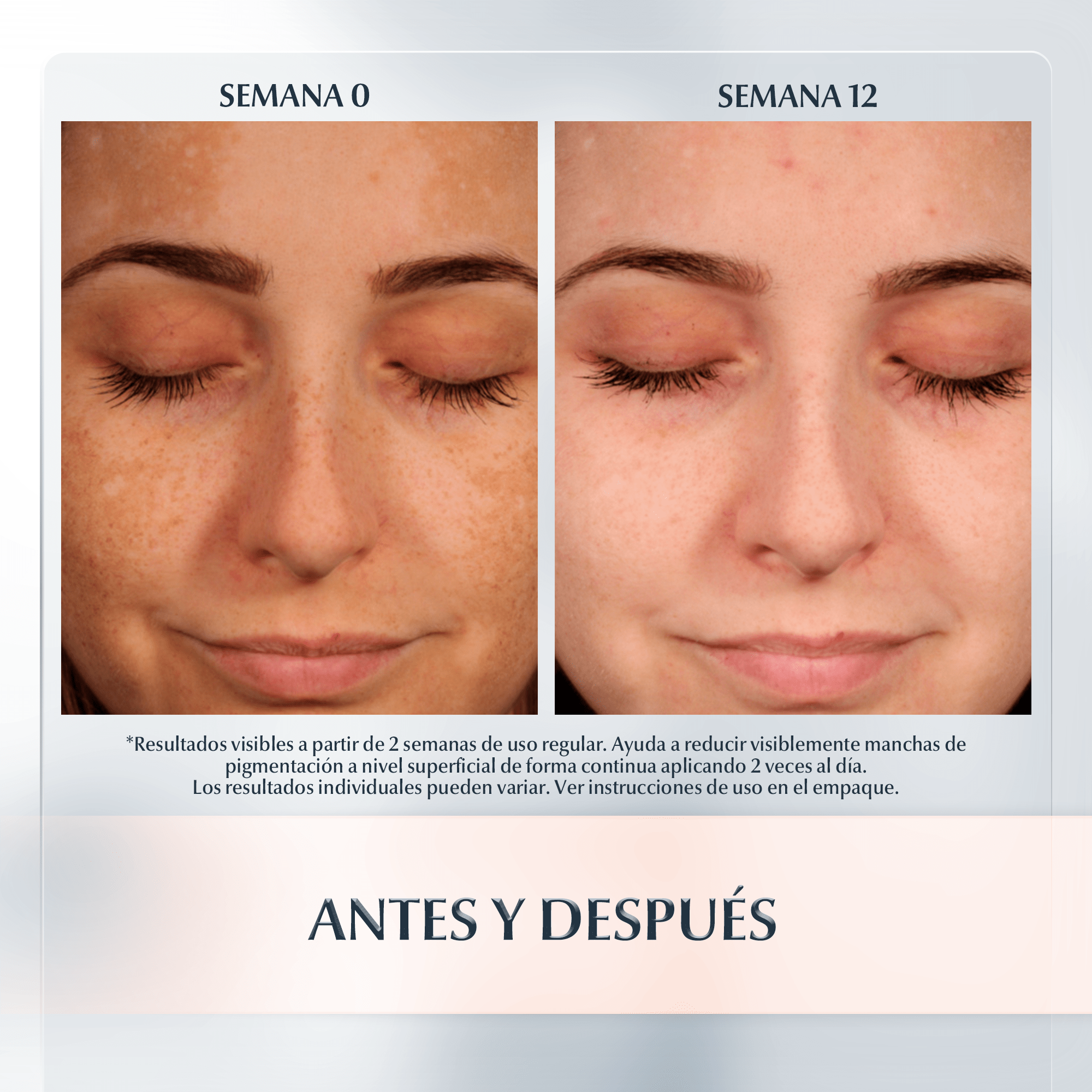 Antes y después de usar ANTI-PIGMENT Crema facial de Noche