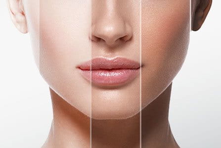 ¿Cuáles son los distintos tipos de piel?