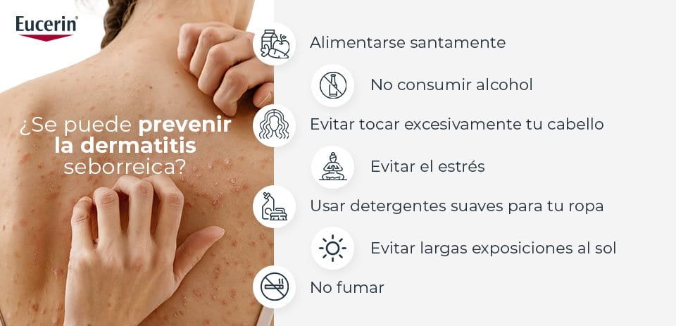 Como prevenir la dermatitis saborreica