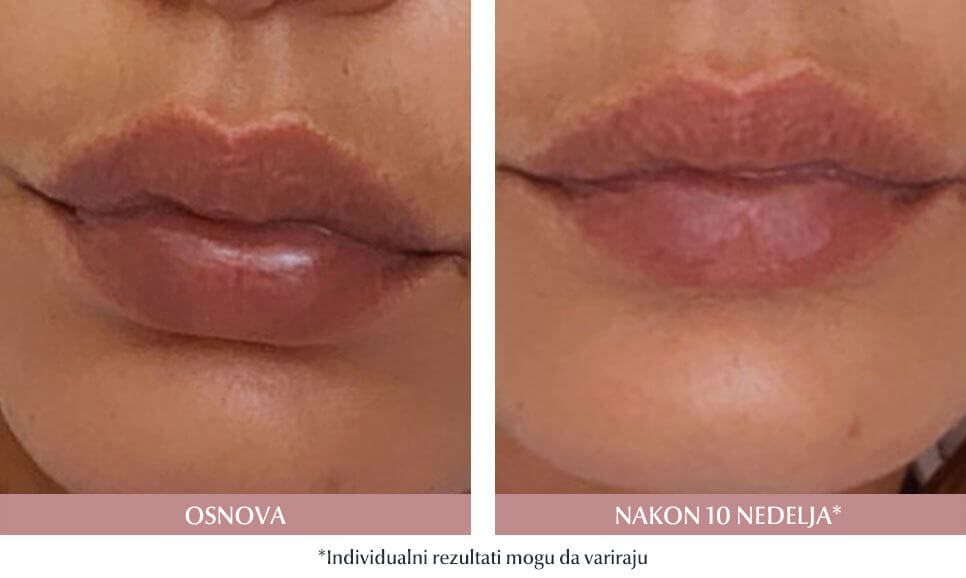 AIDA JOKANOVIĆ, 38, SRBIJA