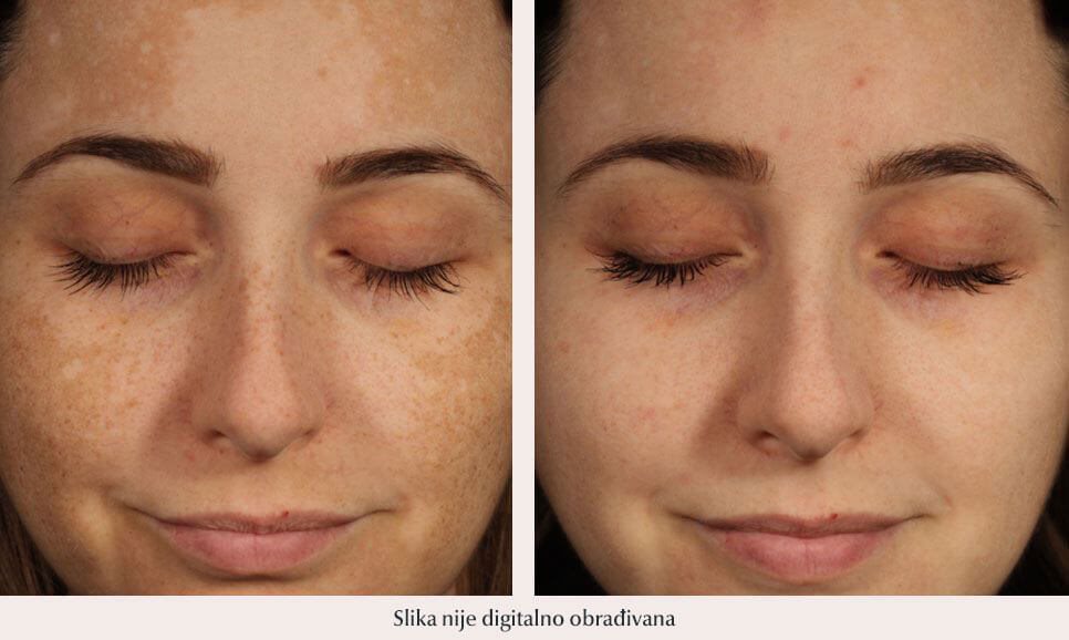 PETRA MAJER, 35, NEMAČKA