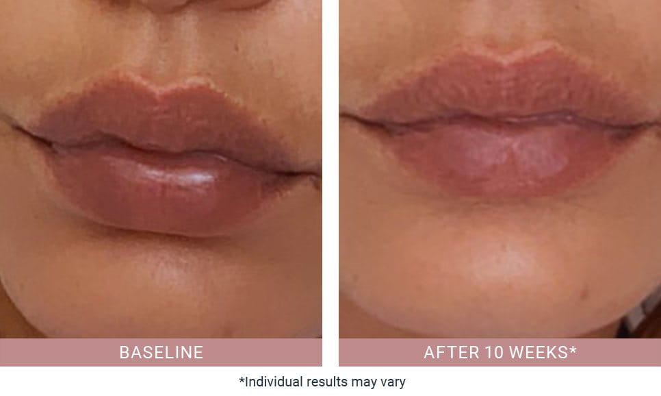 Anti-Pigment-Comparison-Aida