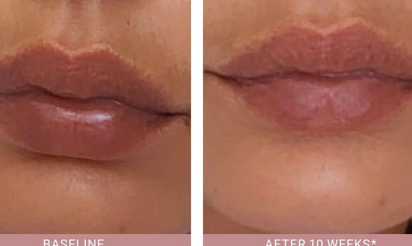 Anti-Pigment-Comparison-Aida