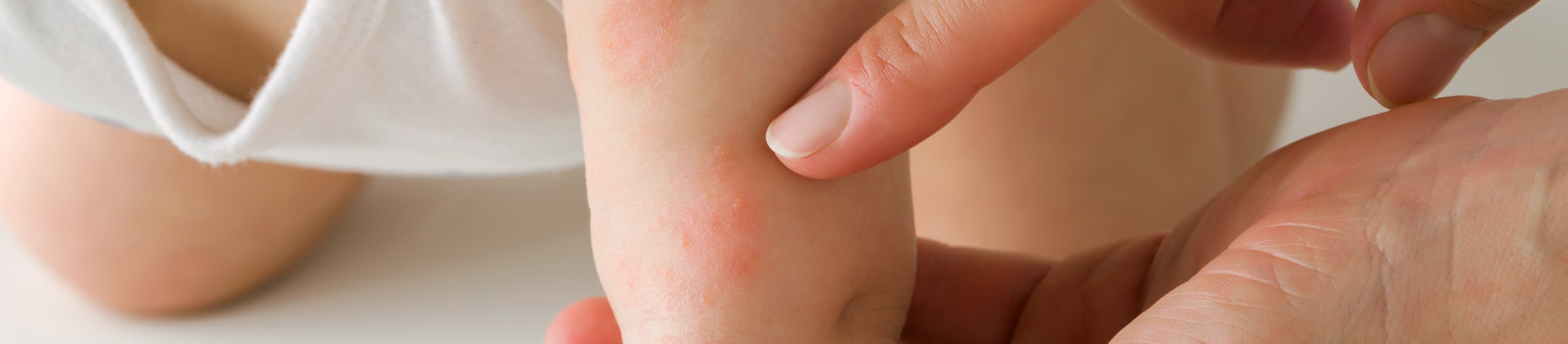 baby skin