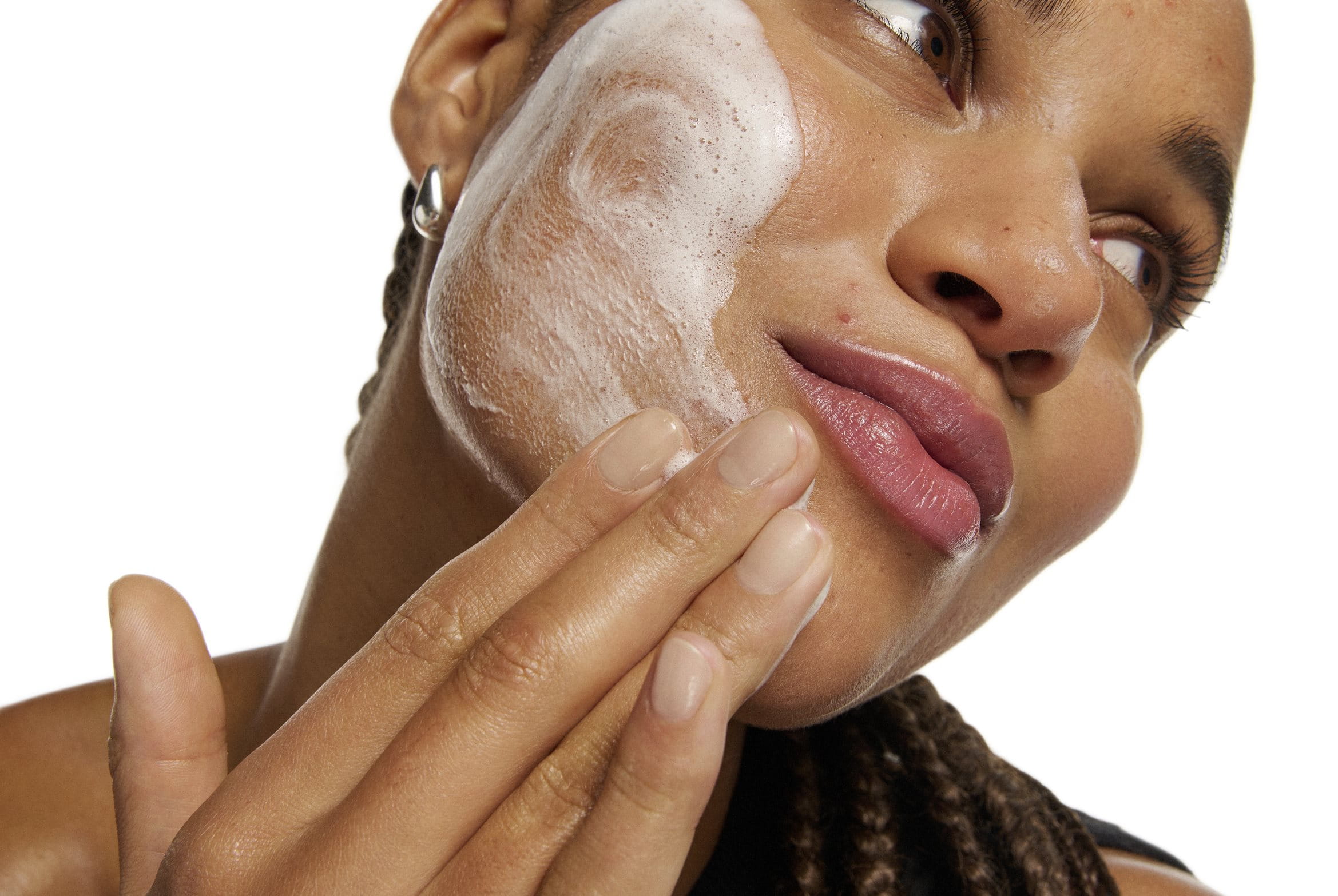 acne-factores-contribuyentes -tratamientos-soluciones