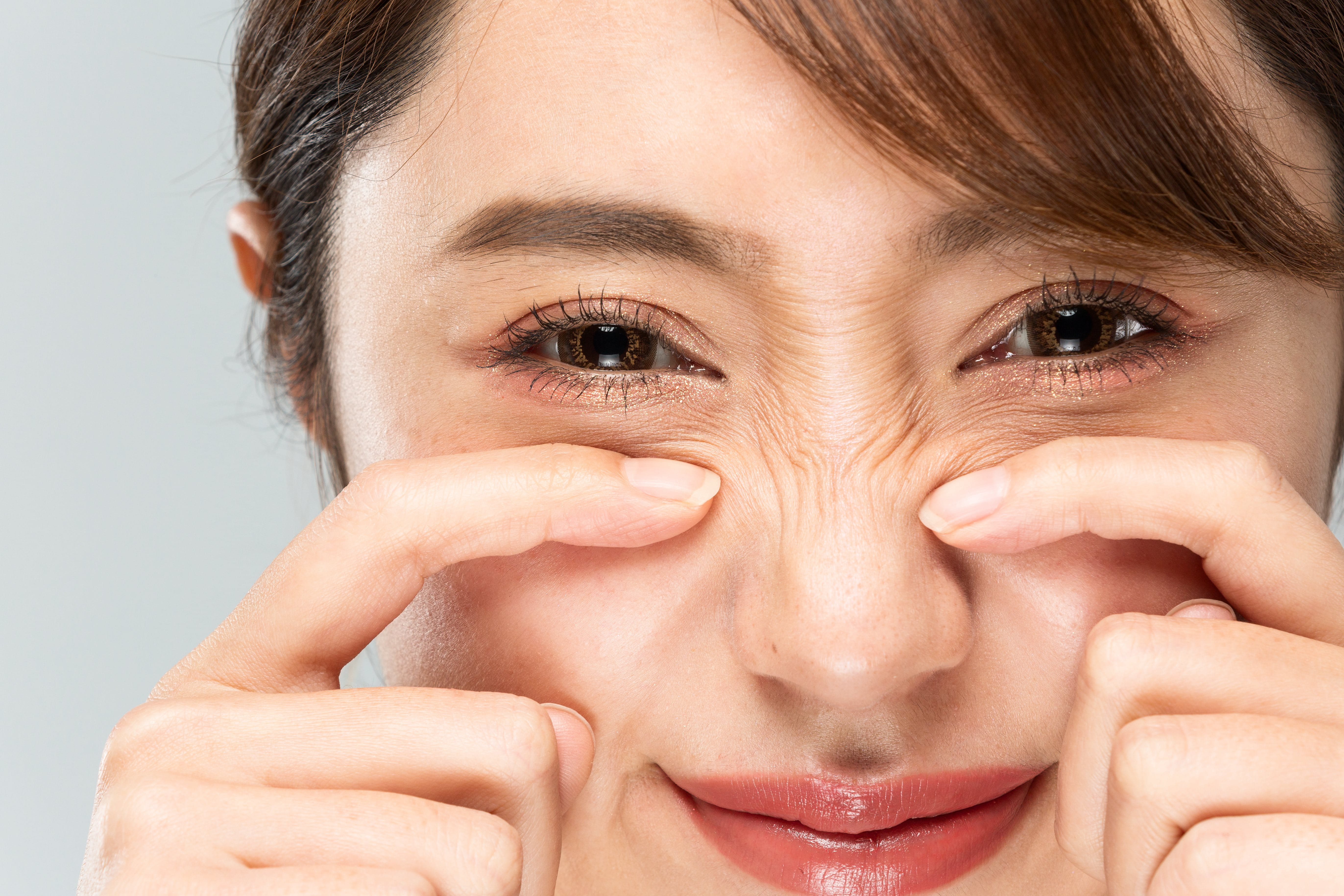 Mitesser niemals selbst ausdrücken, da dadurch Bakterien in die Haut gelangen und neue Mitesser bilden können.