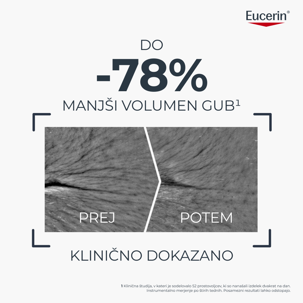 Rezultati klinične študije na sliki pred in po uporabi kažejo, da je Eucerin Hyaluron-Filler + Longevity Epigenetic serum zmanjšal volumen gub za do -78 %.