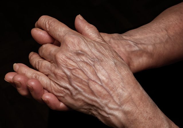 pelle sottile nelle mani degli anziani