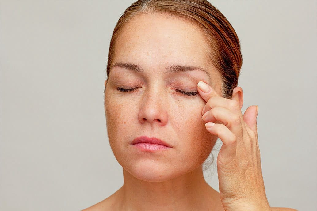 Arrossamenti sul viso dopo il bagno di vapore