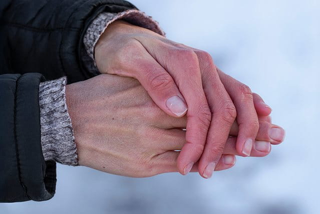foto di mani con dermatite da freddo