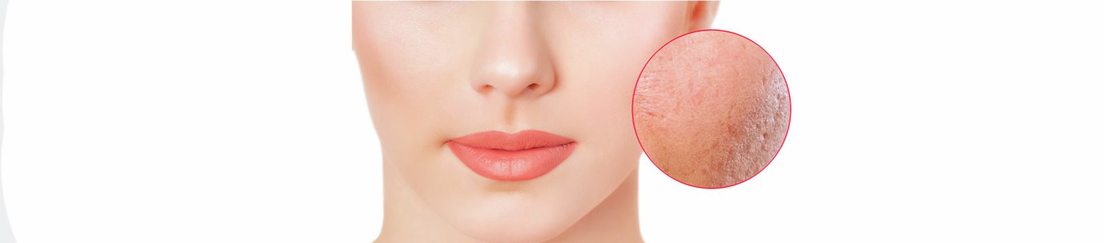 Effetto pilling sulla pelle