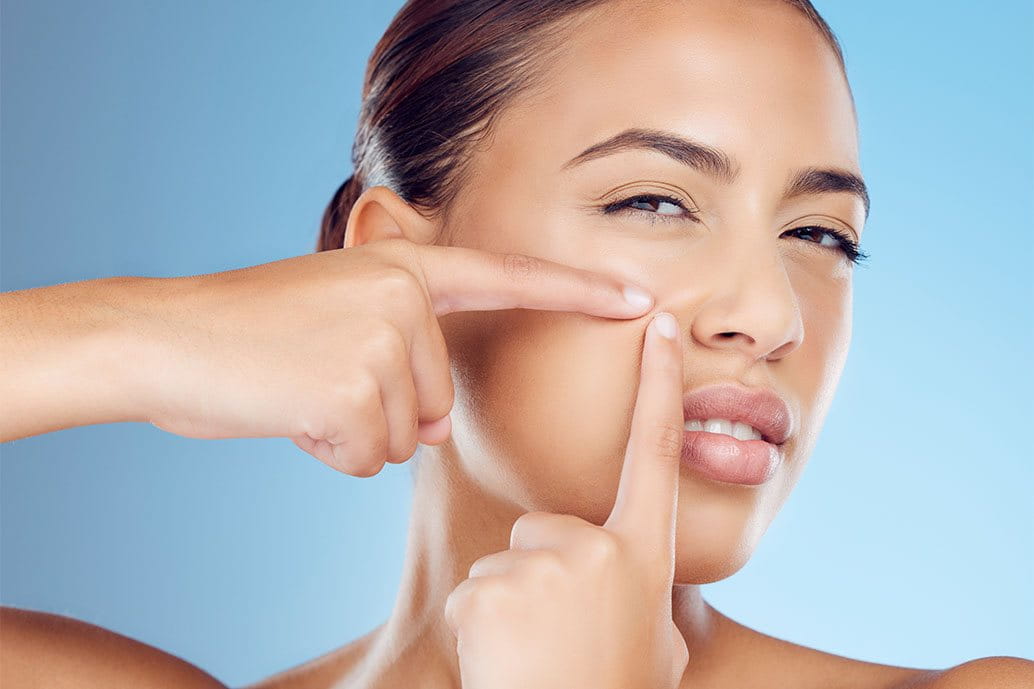 schiacciare i punti neri