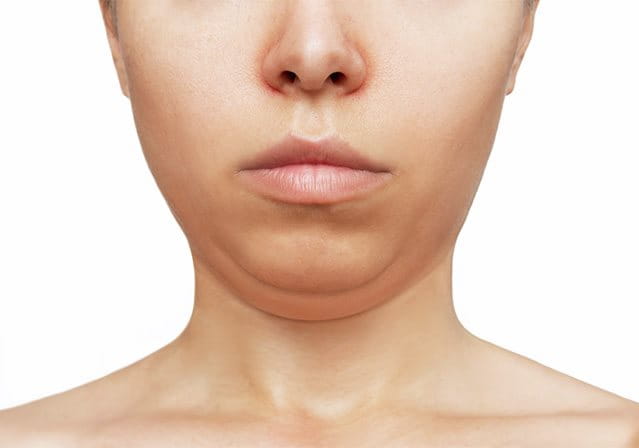 foto di donna con doppio mento