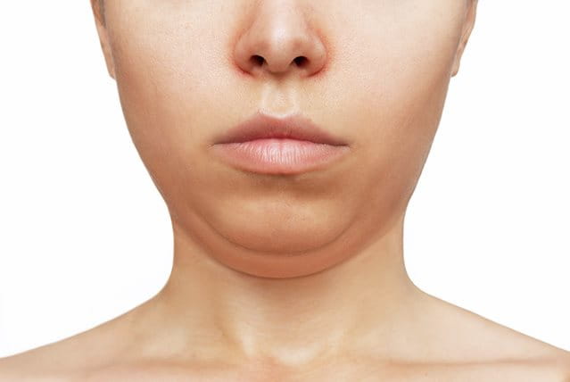 foto di donna con doppio mento
