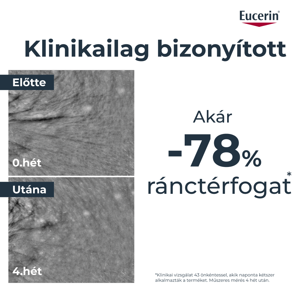 Előtte és utána kép egy klinikai vizsgálat eredményeit mutatja, amelyben az Eucerin Hyaluron-Filler + Longevity Epigenetic ráncfeltöltő szérum akár -78%-kal csökkentette a ráncok láthatóságát