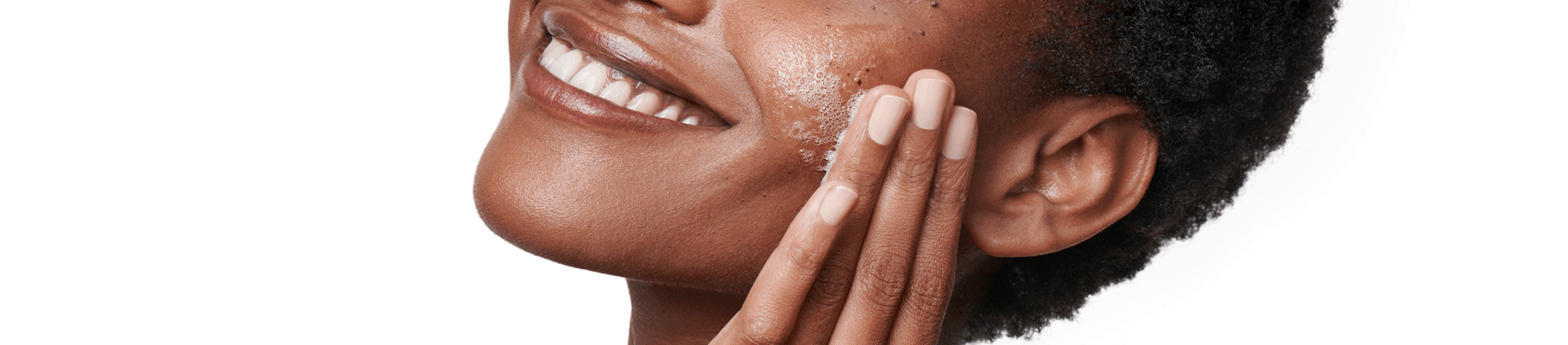 Les marques post-acné sont plates et hyperpigmentées, tandis que les cicatrices post-acné modifient à la fois la texture et l'aspect de la peau.