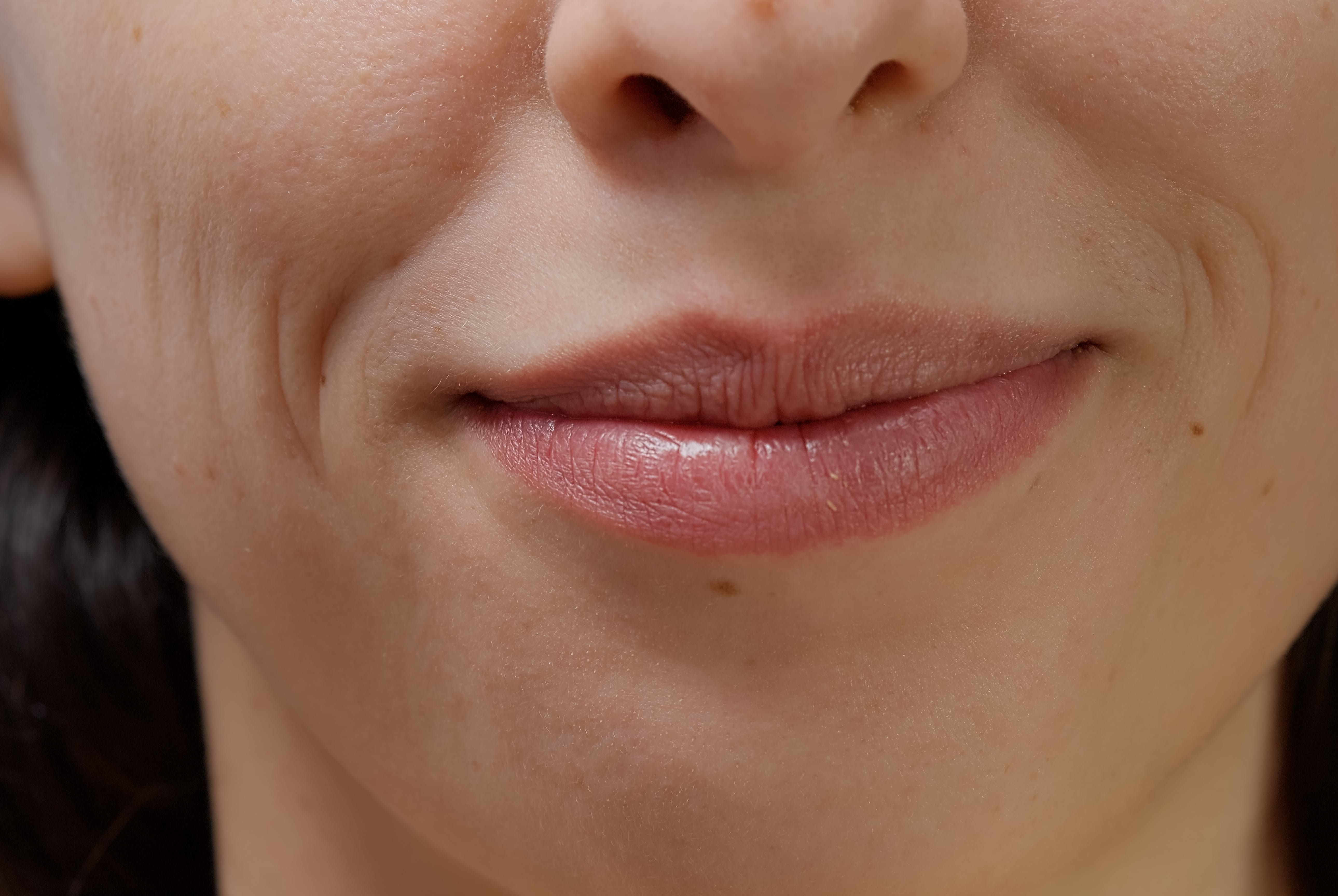 Humidity, Sensitive Skin and Why It Matters