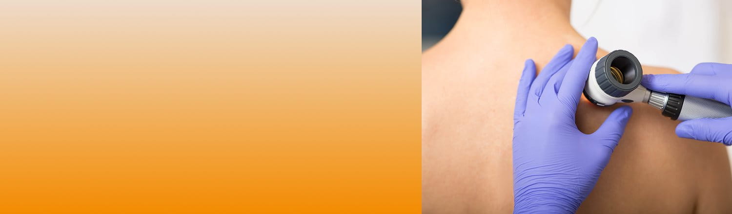 Egy bőrgyógyász egy páciens vállát vizsgálja