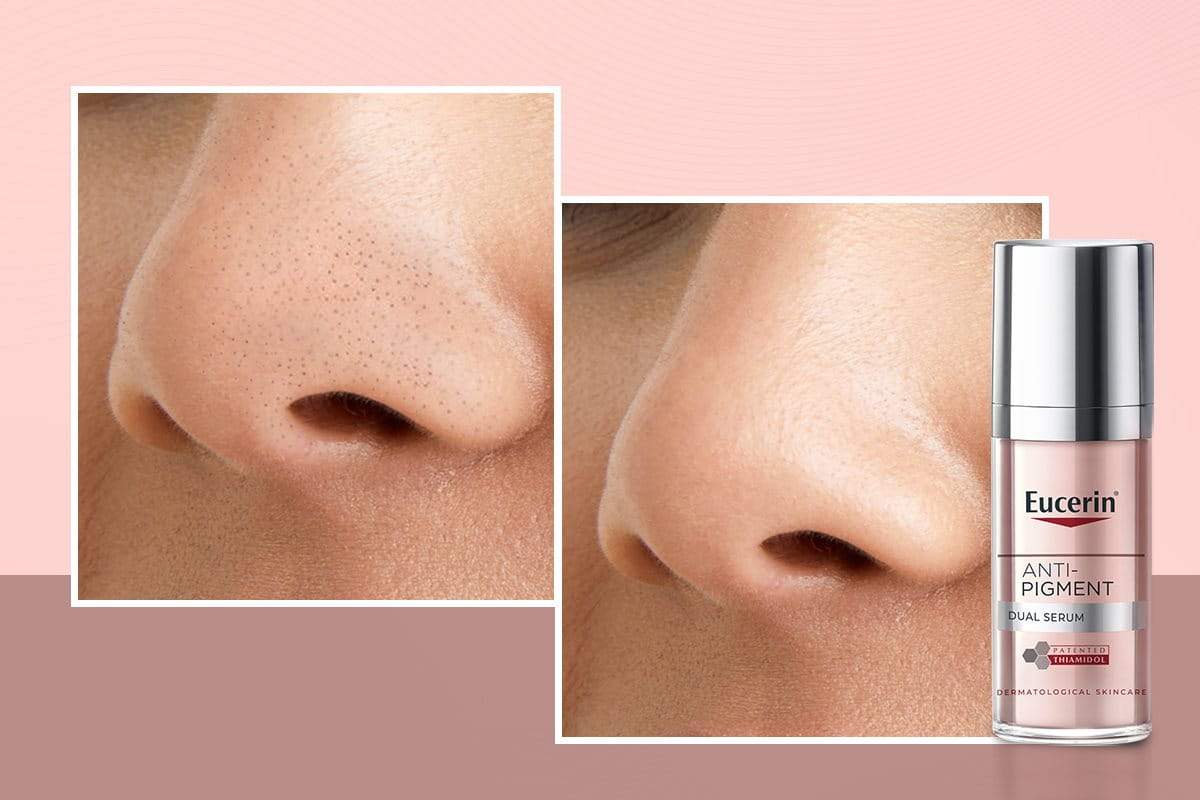 Blackhead removal serum