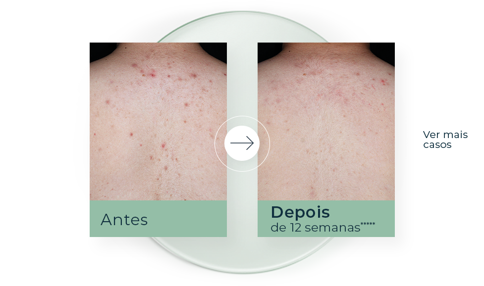 histórias de sucesso