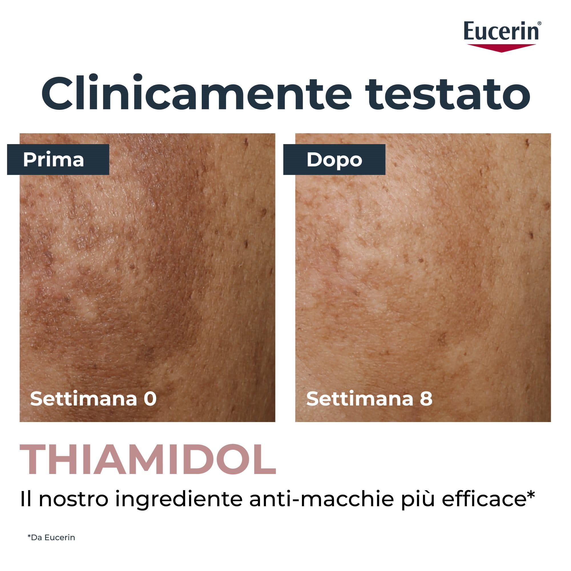 Immagini ravvicinate "prima e dopo" della pelle che mostrano una riduzione delle macchie scure dopo otto settimane, accompagnate dalle diciture "Clinicamente testato" e "THIAMIDOL:il nostro ingrediente anti-macchie più efficace", con una nota a piè di pagina.
