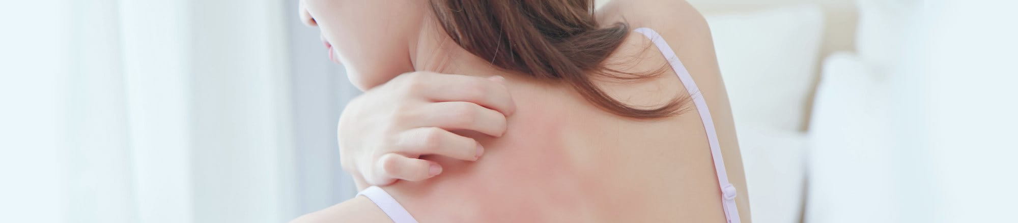 Dermatite psicosomatica