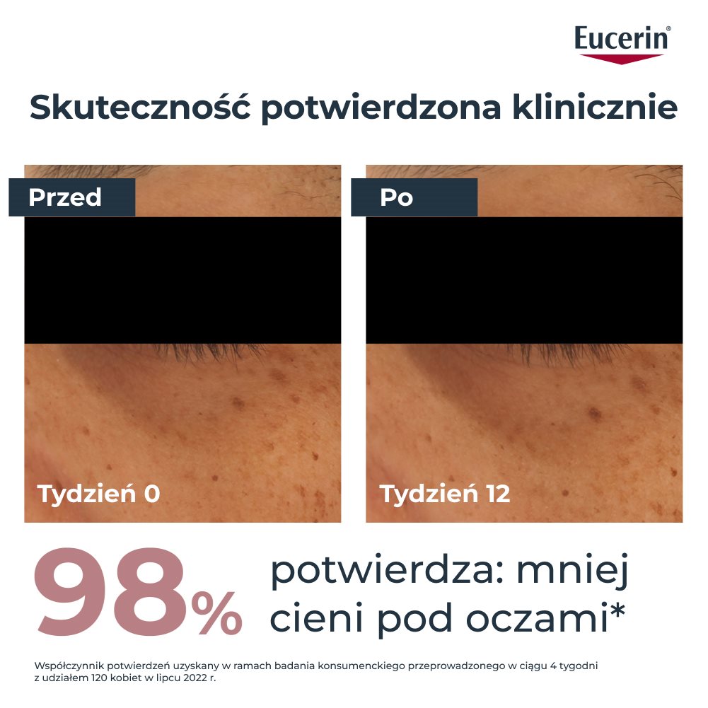 Zdjęcia „przed” i „po” pokazujące zmniejszenie widoczności cieni pod oczami po 12 tygodniach stosowania. Grafika pokazuje również, że 98% uczestników badania konsumenckiego trwającego 4 tygodnie potwierdza zmniejszenie widoczności cieni pod oczami.