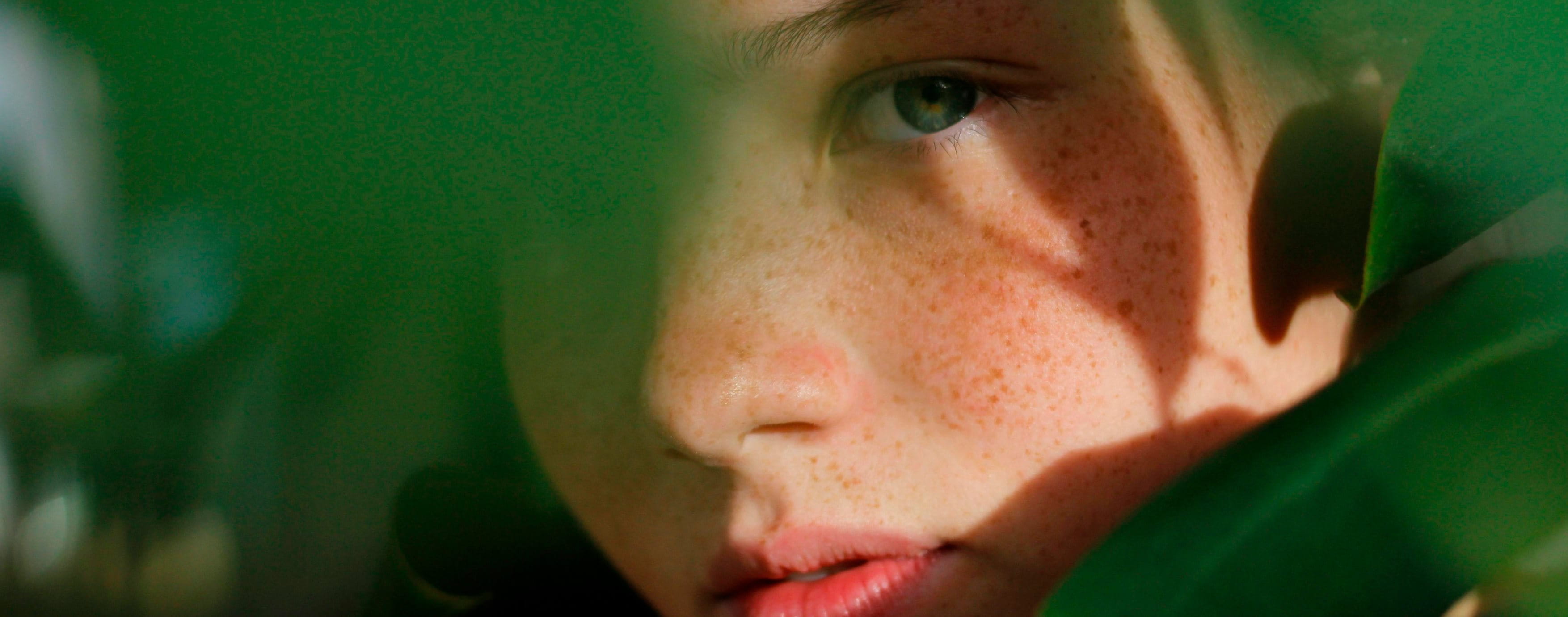 por-que-aparecen-pecas-en-la-piel-eucerin