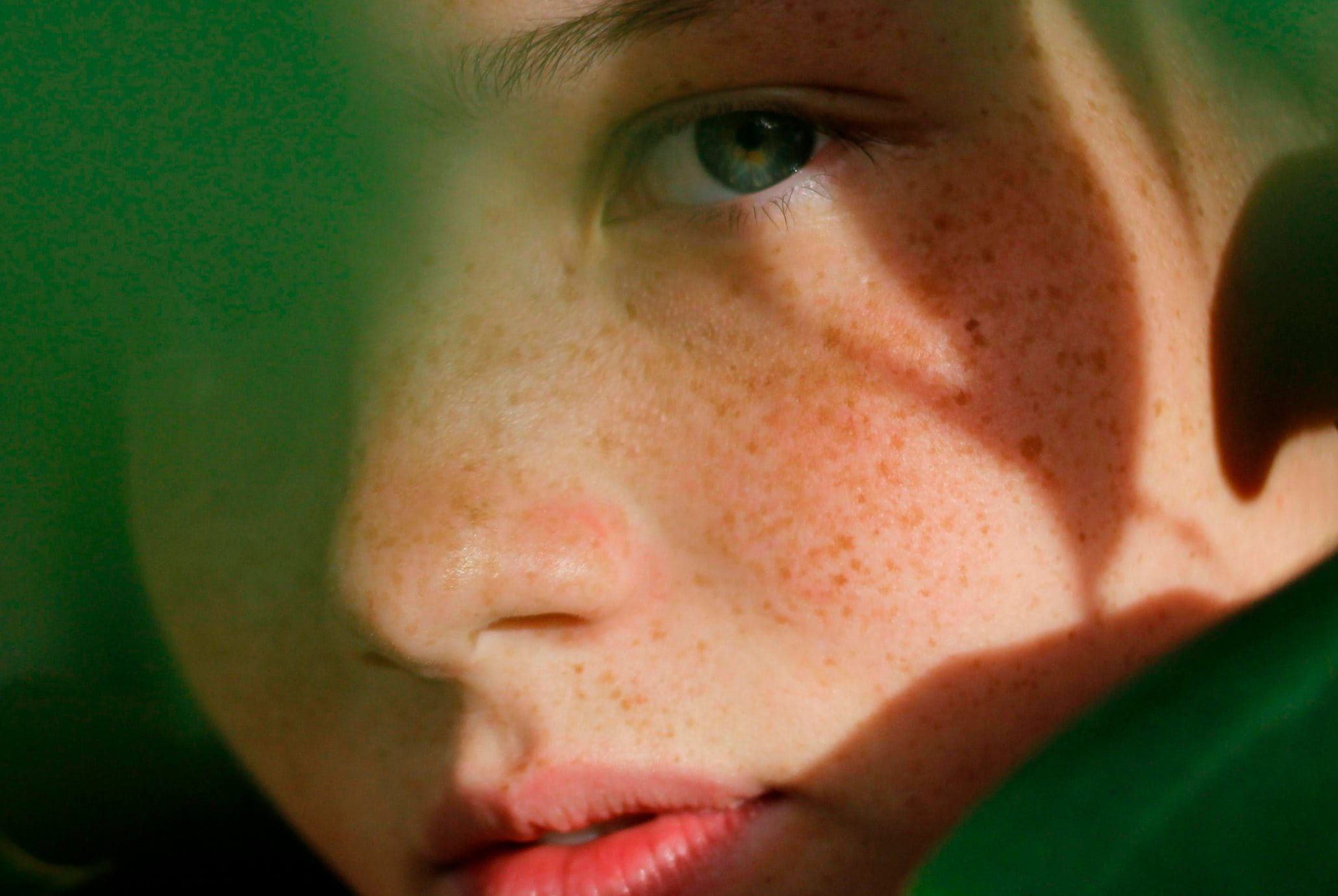 por-que-aparecen-pecas-en-la-piel-eucerin