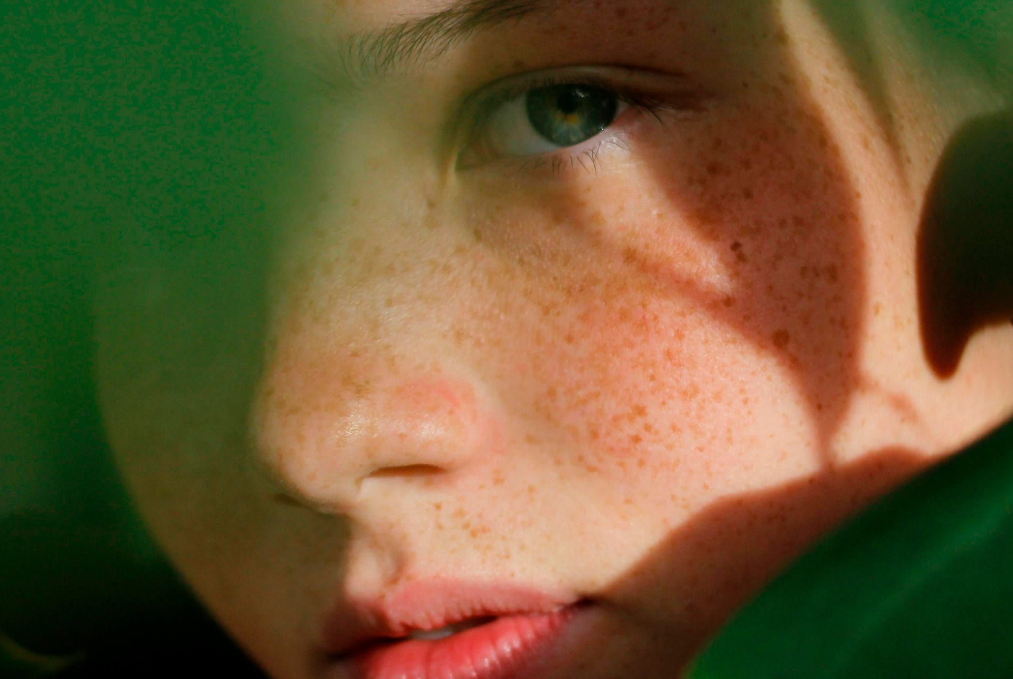 por-que-aparecen-pecas-en-la-piel-eucerin