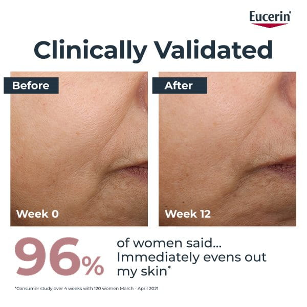 A study result of before and after using Eucerin Anti Pigment Day Cream SPF30