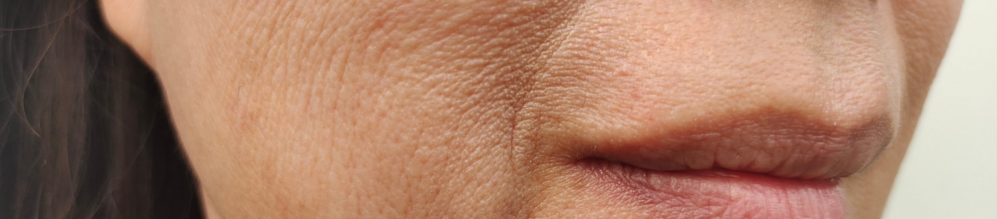 Nahaufnahme der unteren Gesichtshälfte einer erwachsenen Person mit sichtbarer Hautstruktur, feinen Linien, leichten Falten und dünner Haut.