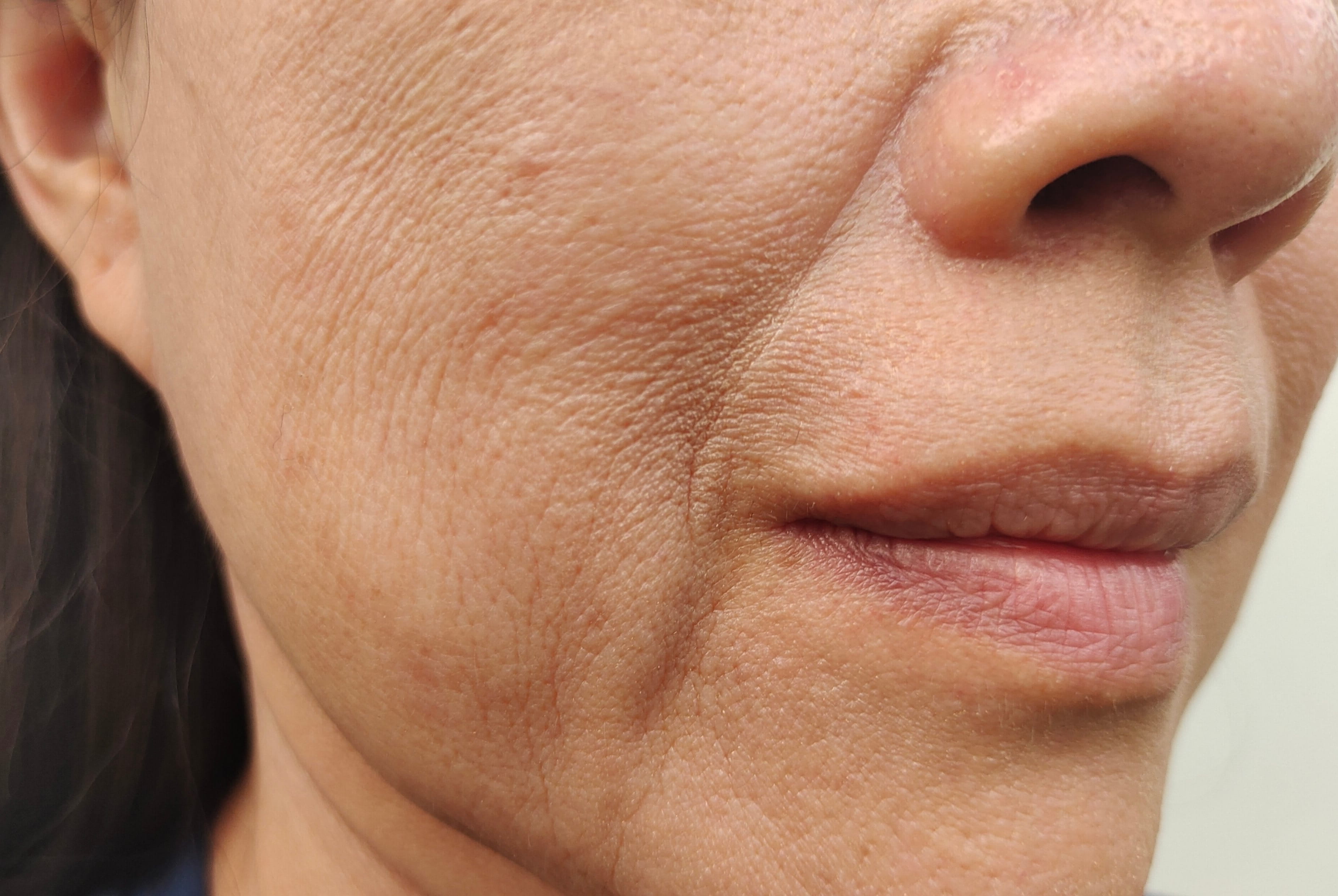 Nahaufnahme der unteren Gesichtshälfte einer erwachsenen Person mit sichtbarer Hautstruktur, feinen Linien, leichten Falten und dünner Haut.